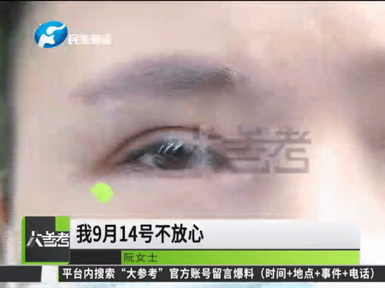 郑州一女子割双眼皮后变“白眉大侠”！医生诊断竟是初期白癜风