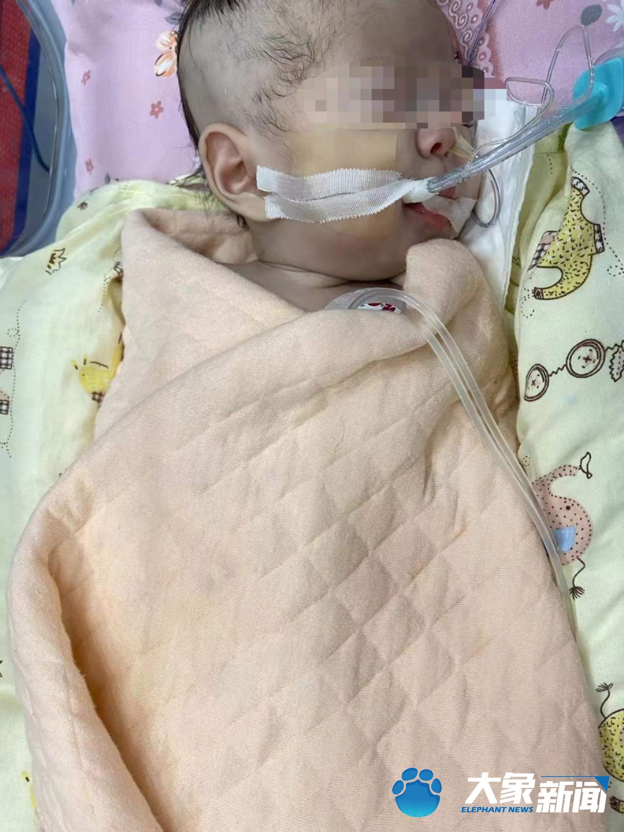 手术成功！郑州3个月先心病女婴成功摘下呼吸机